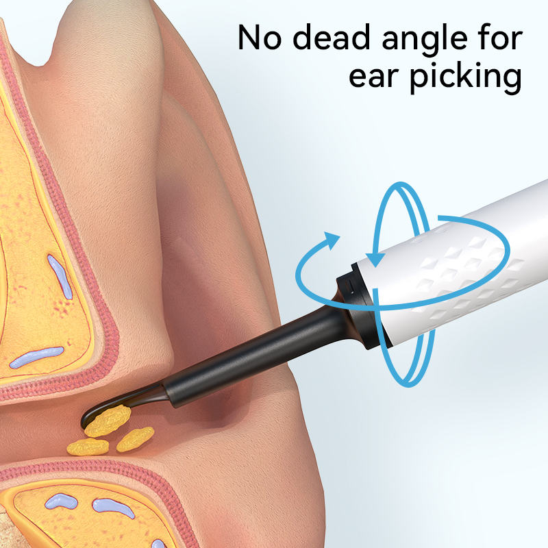 ビデオカメラ用耳掃除器、耳垢掃除用耳鏡、USB電源式耳綿棒、 - Health Power Tools のレビューと価格